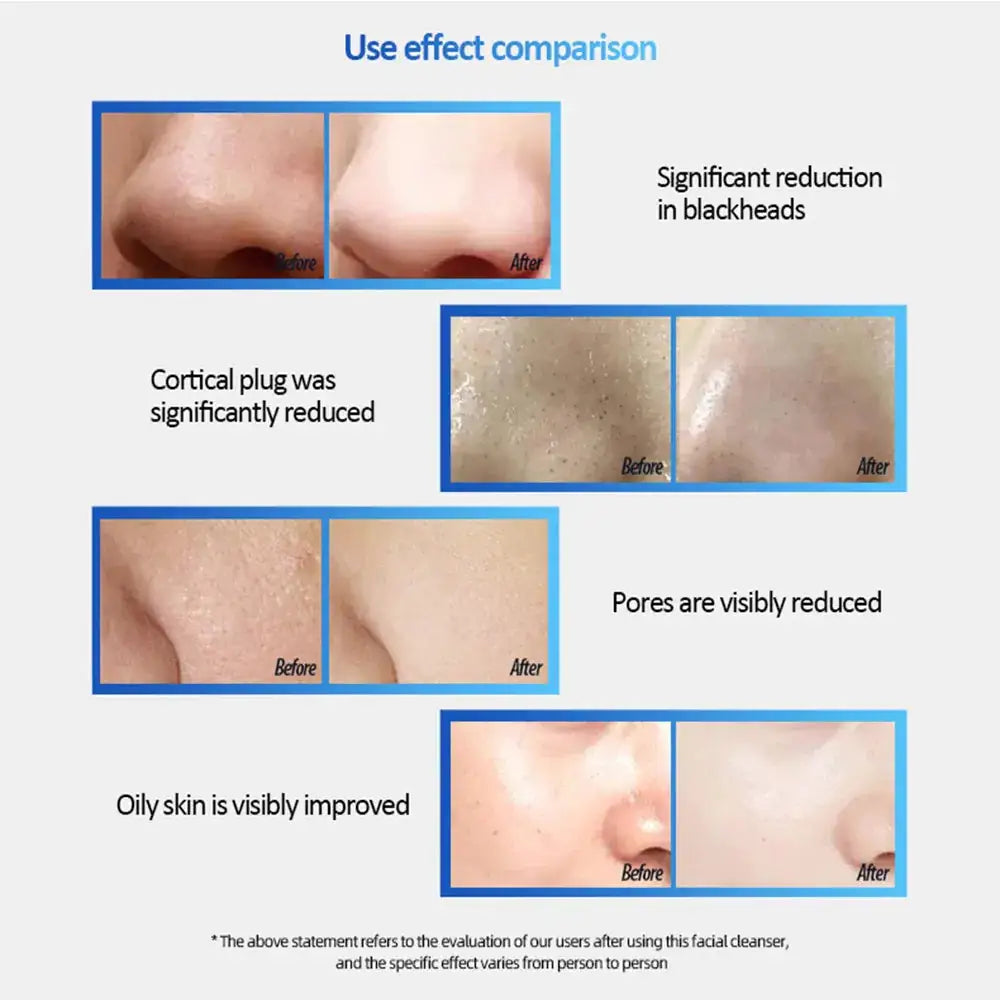 Facial Cleansing Brush, Sonic Facial Brush With 3 Brush Heads For Daily Skin Care, Rechargeable And Gentle Face Exfoliator